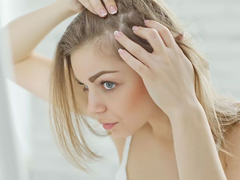 QUEDA DE CABELO QUAIS AS CAUSAS E TRATAMENTOS DISPONÍVEIS? QUEDA DE CABELO QUAIS AS CAUSAS E TRATAMENTOS DISPONÍVEIS?
