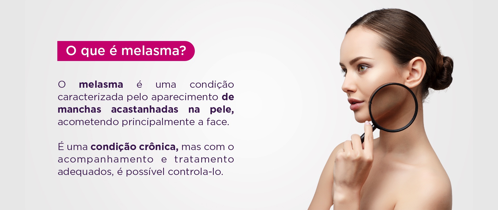 Melasma - MYBELEZA