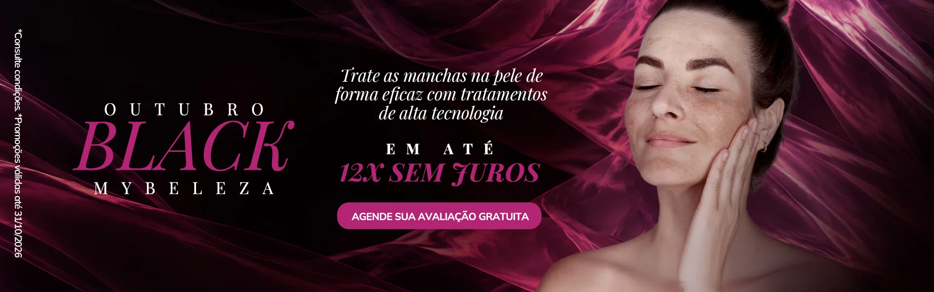 Melasma - MYBELEZA